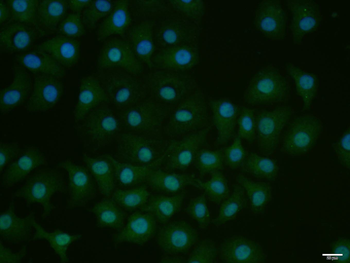 Phospho-E2F1 (Ser337) Rabbit Polyclonal Antibody