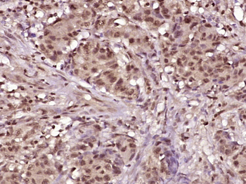 Phospho-E2F1 (Ser337) Rabbit Polyclonal Antibody
