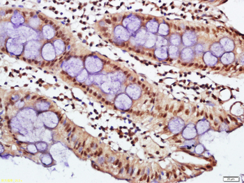 Phospho-E2F1 (Ser332) Rabbit Polyclonal Antibody