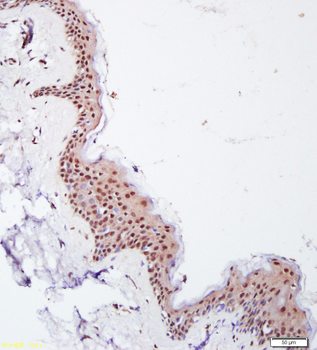 Phospho-E2F1 (Ser332) Rabbit Polyclonal Antibody