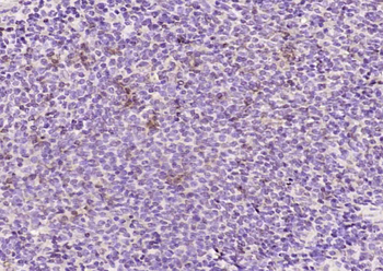 E2EPF Rabbit Polyclonal Antibody