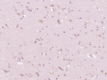 Phospho-EGFR (Tyr1110) Rabbit Polyclonal Antibody