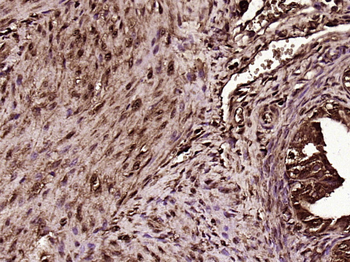 Phospho-EGFR (Tyr1016) Rabbit Polyclonal Antibody