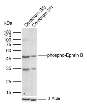 Phospho-Ephrin B (Ser300) Rabbit Polyclonal Antibody