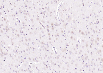 MAPK4 Rabbit Polyclonal Antibody