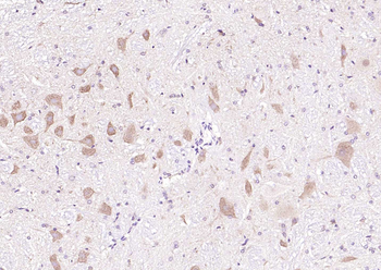 MAPK4 Rabbit Polyclonal Antibody