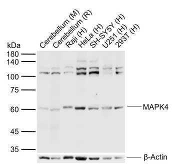 MAPK4 Rabbit Polyclonal Antibody
