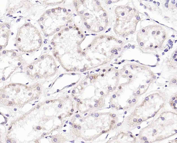 Phospho-ERK5 (Ser731+Thr733) Rabbit Polyclonal Antibody