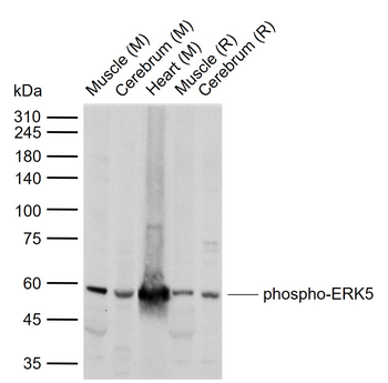 Phospho-ERK5 (Ser731+Thr733) Rabbit Polyclonal Antibody