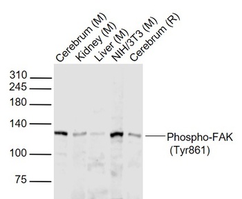 FAK (phospho-Tyr861) antibody