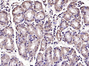Phospho-FAK (Tyr925) Rabbit Polyclonal Antibody