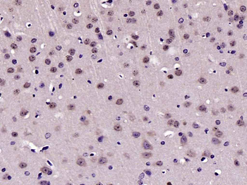 Phospho-FAK (Tyr925) Rabbit Polyclonal Antibody