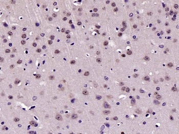 FAK (phospho-Tyr925) antibody