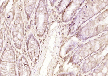 FBP2 Rabbit Polyclonal Antibody
