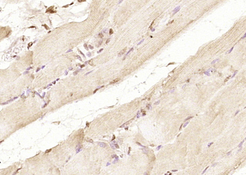 FBP2 Rabbit Polyclonal Antibody