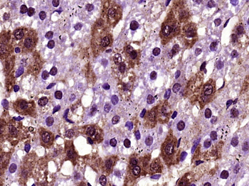 FGF21 Rabbit Polyclonal Antibody