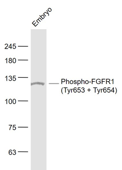 Phospho-FGFR1 (Tyr653 + Tyr654) Rabbit Polyclonal Antibody