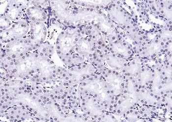 FGFR1 (phospho-Tyr307) antibody
