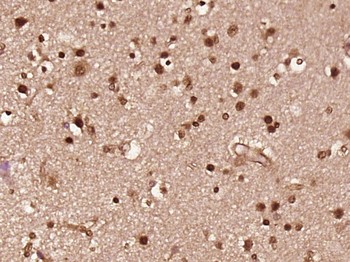 Phospho-FGFR1+FGFR2 (Tyr463/Tyr466) Rabbit Polyclonal Antibody