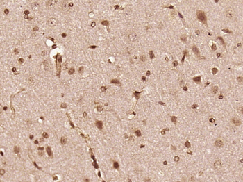 Phospho-FGFR1+FGFR2 (Tyr463/Tyr466) Rabbit Polyclonal Antibody