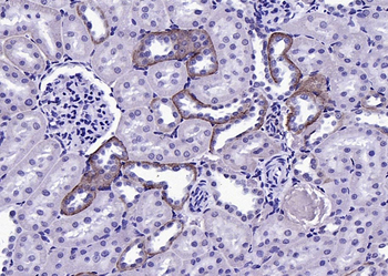 Phospho-FGFR1+FGFR2 (Tyr463/Tyr466) Rabbit Polyclonal Antibody