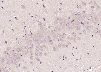 Phospho-FLT3 (Tyr842) Rabbit Polyclonal Antibody