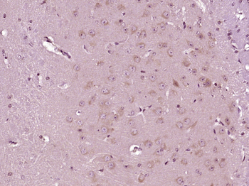ABCG1 Rabbit Polyclonal Antibody