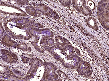 Galectin 3 Mouse Monoclonal Antibody