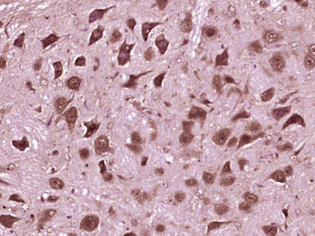 Peroxiredoxin-6 Rabbit Polyclonal Antibody