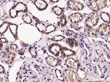 VDAC Rabbit Polyclonal Antibody