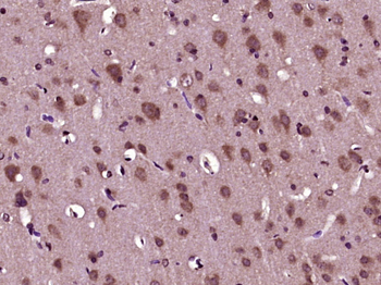 IL-6R alpha Rabbit Polyclonal Antibody