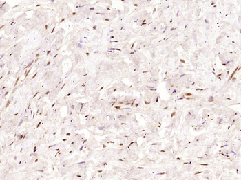 AMPK gamma1 Mouse Monoclonal Antibody