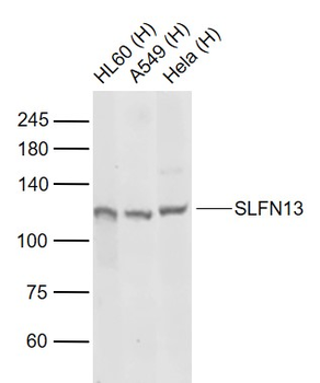 SLFN13 Rabbit Polyclonal Antibody