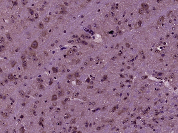 RABGGTA Rabbit Polyclonal Antibody