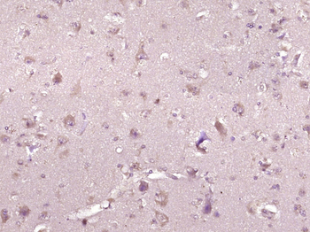 PKD2L1 Rabbit Polyclonal Antibody