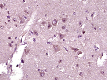 ABCA1 Rabbit Polyclonal Antibody