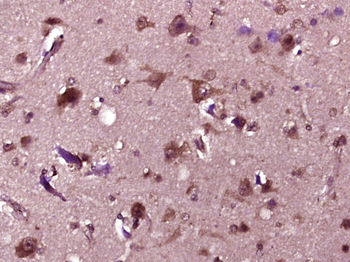 ABCA1 Rabbit Polyclonal Antibody