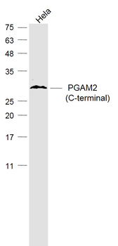 PGAM2 (C-terminal) Rabbit Polyclonal Antibody
