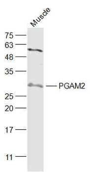 PGAM2 (C-terminal) Rabbit Polyclonal Antibody