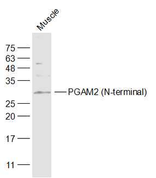 PGAM2 (N-terminal) Rabbit Polyclonal Antibody