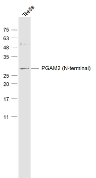 PGAM2 (N-terminal) Rabbit Polyclonal Antibody
