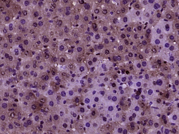 C10orf96 Rabbit Polyclonal Antibody