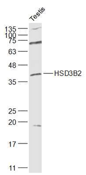 HSD3B2 Rabbit Polyclonal Antibody