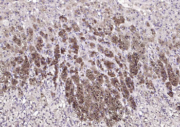 HSD3B1+ HSD3B2 Rabbit Polyclonal Antibody