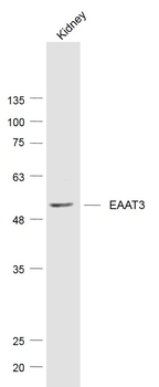 EAAT3 Rabbit Polyclonal Antibody
