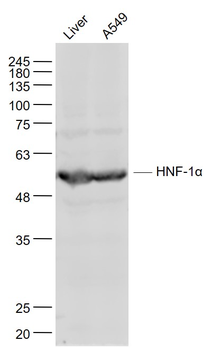 HNF-1α Rabbit Polyclonal Antibody
