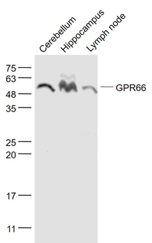 NMUR1/GPR66 Rabbit Polyclonal Antibody