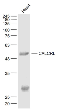 CALCRL Rabbit Polyclonal Antibody