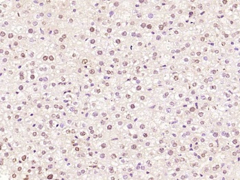 E2F3 antibody