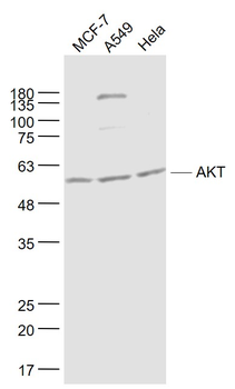 AKT Mouse Monoclonal Antibody